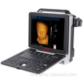 Pengimbas Ultrasound 4D Doppler Warna Mudah Alih UW-P6